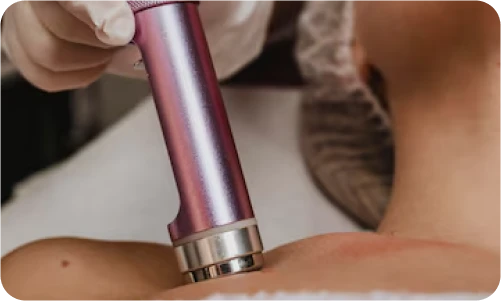Laser terapia.webp