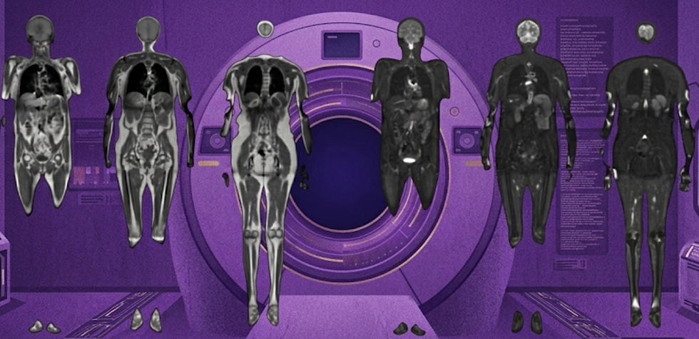 34th Edition | Screening. Top to Bottom, and Low to High.