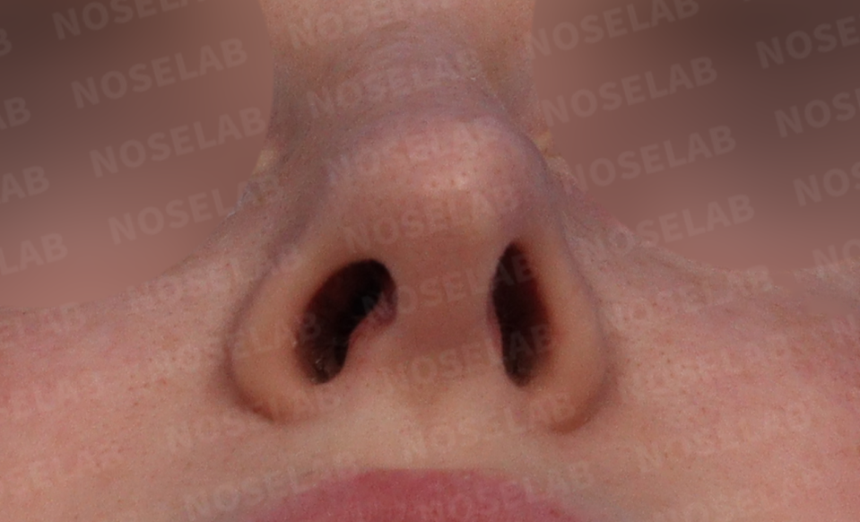 Nostril view