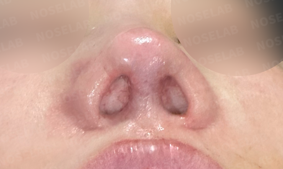 Photo of the nostrils
