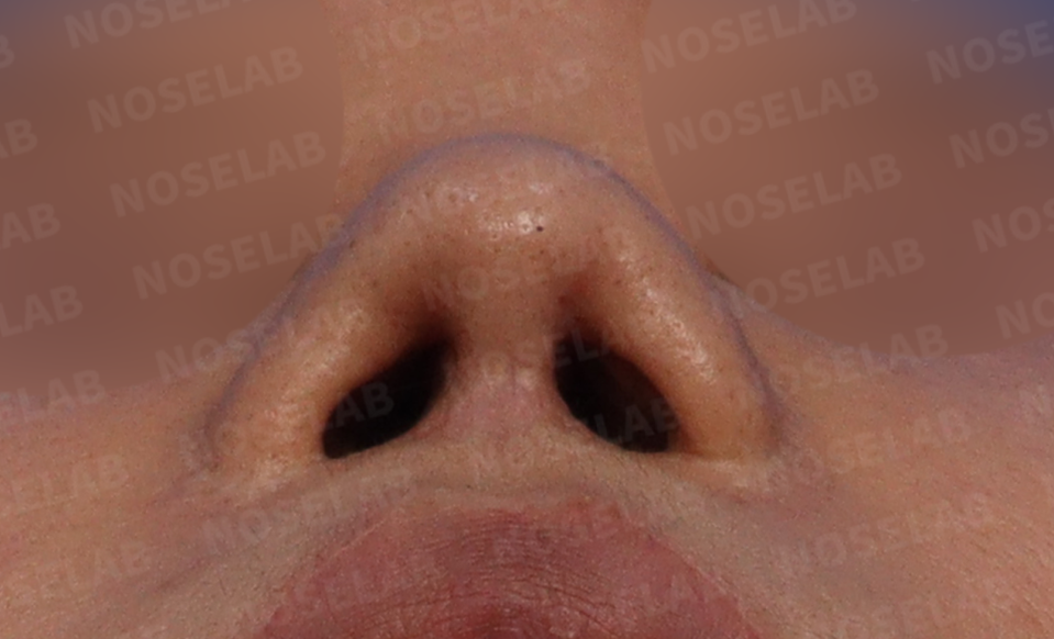 Nostril view