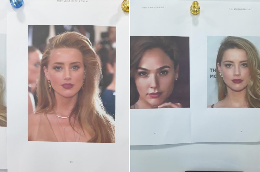 Reference photos of female celebrities used during design consultation for revision rhinoplasty after hump removal. Patient desired refined nasal bridge and elegant tip contour.