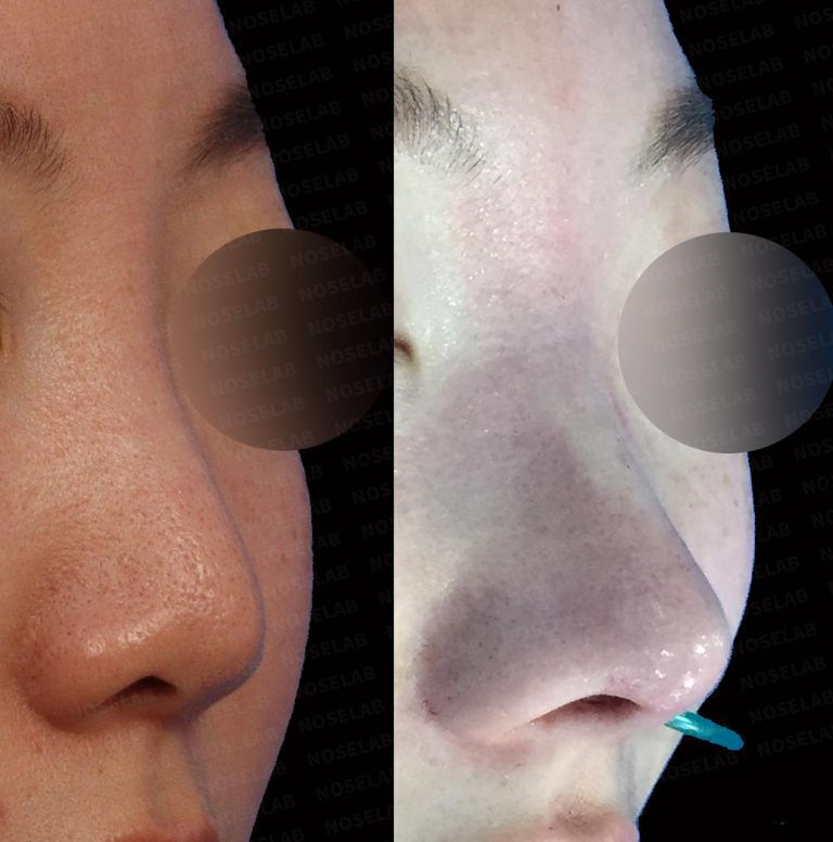 beautiful nose tip