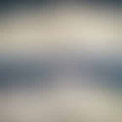 Revision Rhinoplasty Korea oblique before–after showing improved tip rotation and profile.