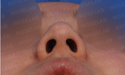 Nostril view