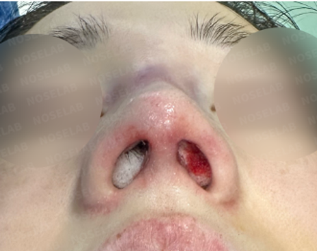 Photo of the nostrils