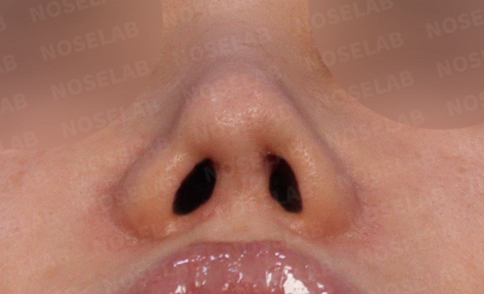 Nostril 