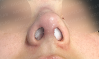Photo of the nostrils