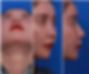 Pre-surgery consultation photos of a female patient: right oblique side view, right side view, and nostril view before revision rhinoplasty.