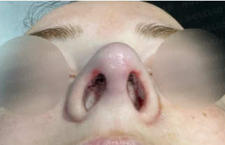 Photo of the nostrils