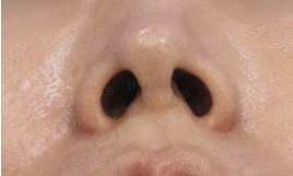 Nostril view