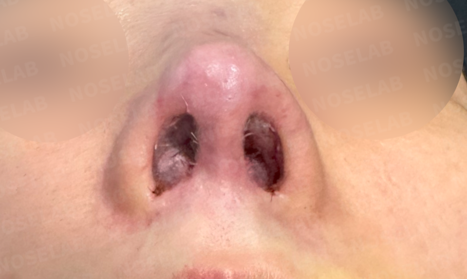 Photo of the nostrils