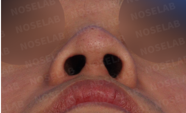 Photo of the nostrils.