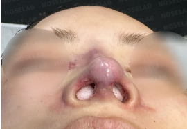 Photo of the nostrils