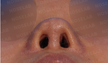 Nostril view