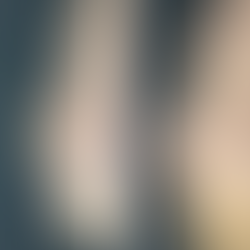 Side profile before and after closed revision rhinoplasty for nostril asymmetry correction.