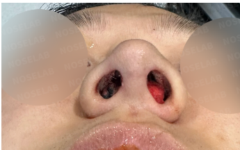 Photo of the nostrils