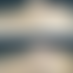 Foreign body removal (filler and thread) with closed rhinoplasty in Korea – pre and postoperative photos