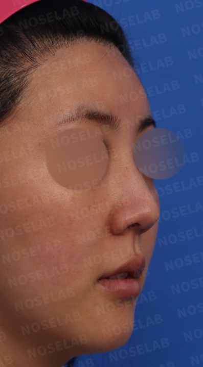 45-degree angle view
