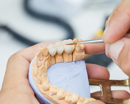 dental crowns and bridges.jpeg