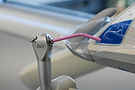 Best Veneers in Orlando.jpg