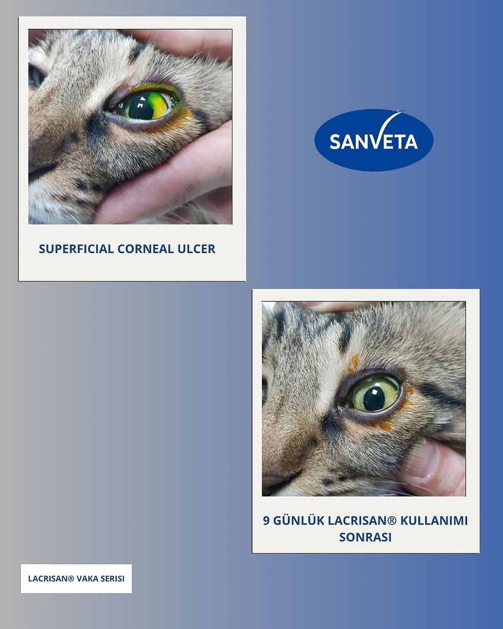 LACRISAN® ile 9 Günde Klinik Başarı: Superficial Corneal Ulser Vakası