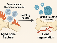 局部釋放氫氣 改善衰老微環境 促進骨再生