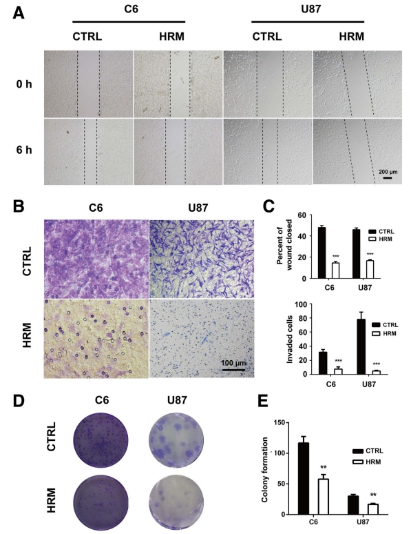 圖A：顯示了在氫氣處理後，細胞的移動能力逐漸減弱。圖B、C：顯示了在氫氣處理後，細胞的侵襲能力明顯下降。圖D、E：顯示了氫氣處理對細胞形成群落的影響。結果顯示，氫氣治療可以顯著抑制C6和U87細胞的遷