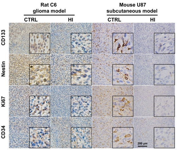圖2：氫氣抑制腦癌細胞的增殖和侵襲，並可能通過抑制血管新生來降低腫瘤生長