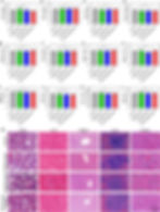 圖7|EPI/CaH₂@Lipiodol經TACE後的短期生物安全性。A–L顯示肝功能、腎功能與血液學指標在各組間未見顯著差異;M為心、肝、脾、肺與腎臟H&E組織切片,未見明顯急性病理損傷。