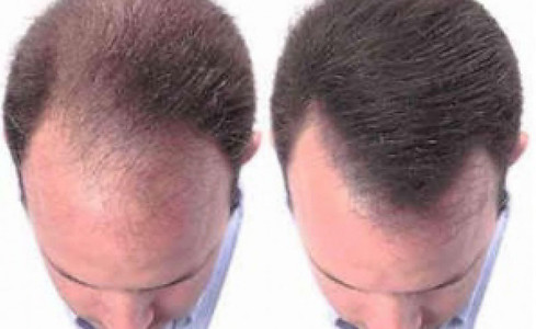 plasma_foto_3 (1).jpg