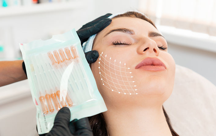 Facial lifting thread. Thread facelift with arrows on face for woman's skin, procedure fac