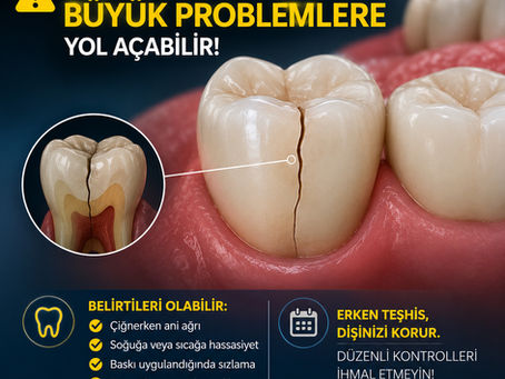 Dişlerde Çatlak Nasıl Anlaşılır? Belirtileri ve Nedenleri | Eskişehir Diş Kliniği