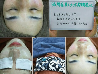 たるみが気になる方は・・・。