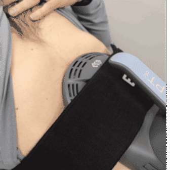 emsculpt-neo-muscle-gif-240px-2.gif