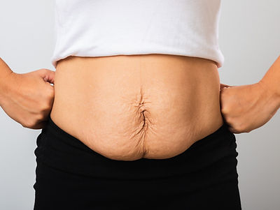Skin Tightening