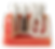 Untitled design 4.png