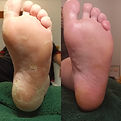Before pedicure and after medi pedi.jpg
