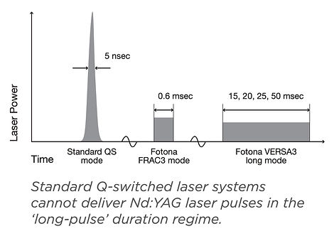MaQX Pulse Durations 1064nm.jpg