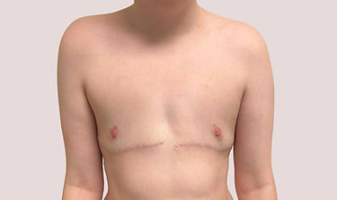 Patient G_post-op.jpg