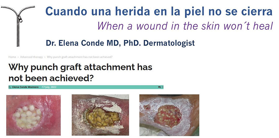 wounds skin grafts elena conde.JPG