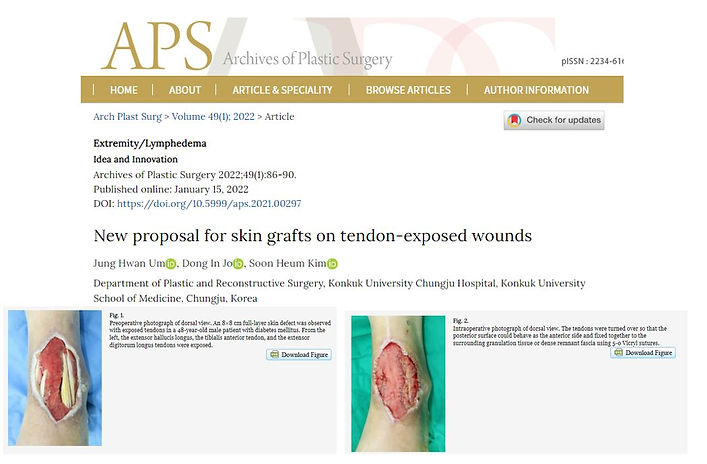 wa skin grafts 7.JPG