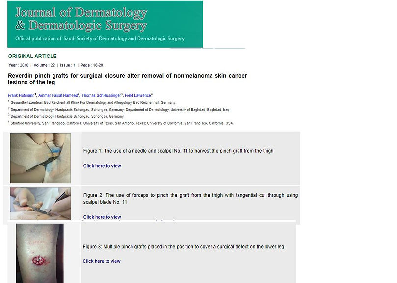 wounds mosaic skin graft.JPG