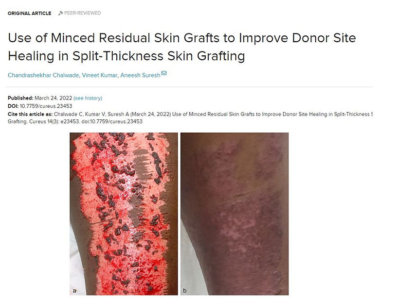 wa skin grafting donor site.JPG