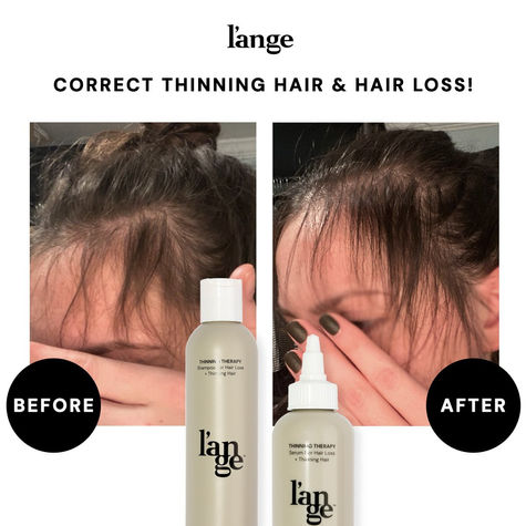 HAIRTHINNING-TF-EVERGREEN-DYNAMIC-ADS-R29C1-EDU