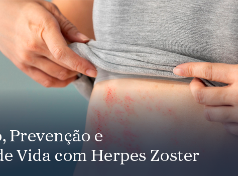 Tratamento, Prevenção e Qualidade de Vida com Herpes Zoster