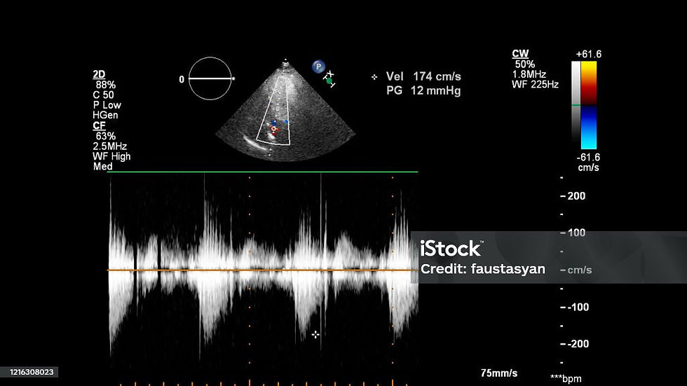 Cardiac Ultrasound