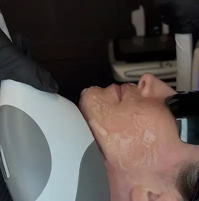 Laser Hair Removal (2) (1).webp