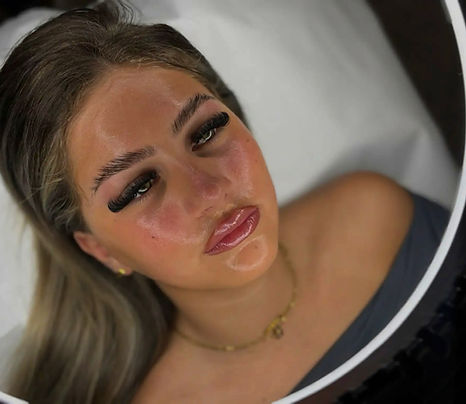 Skin Rejuvenation_edited_edited_edited.jpg