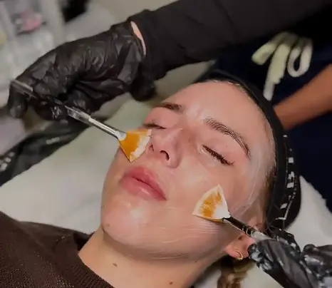 Skin Rejuvenation (2).webp